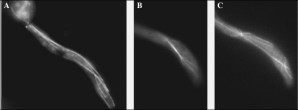 (A): Microtúbulos do fuso (B)e(C): Microtúbulos astrais emanam  dos pólos de um eixo alongado 